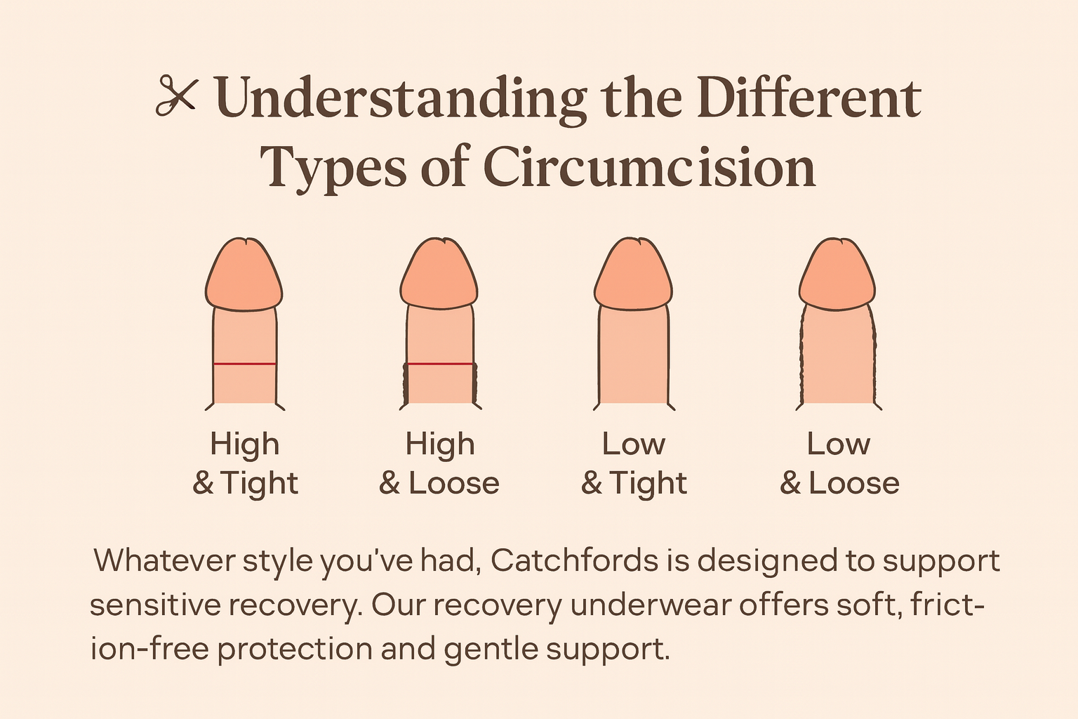 Understanding the Different Types of Circumcision