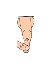 Short Frenulum Recovery Options: Stretching vs Surgery